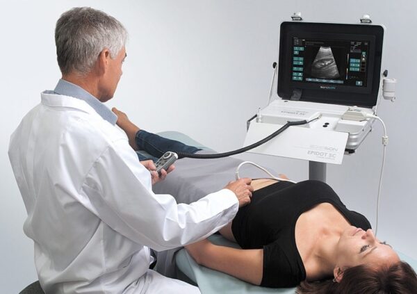 EPIDOT SC Portable, Colour Doppler Ultrasound Scanner - Image 2