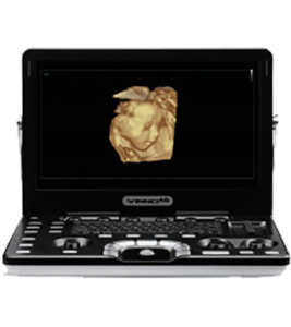 VINNO A6 Laptop Ultrasound Scanner