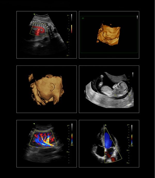 Vinno X2 Affordable 4D Ultrasound Scanner for Sale - Image 3